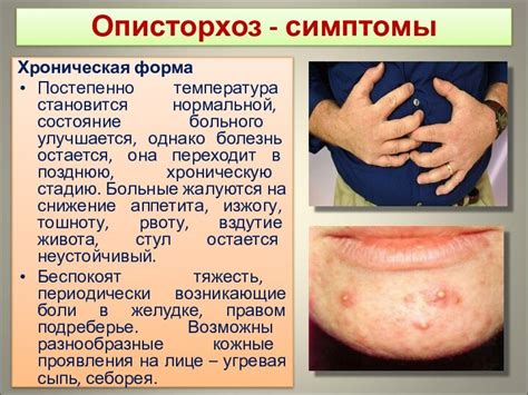 ОПИСТОРХОЗ