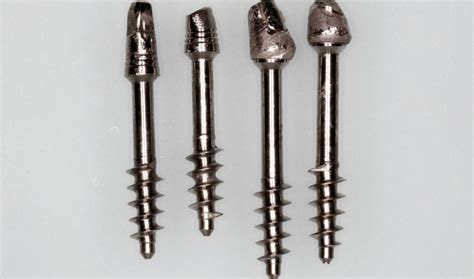 Базальная имплантация, как она есть. — IMPLANT-IN.COM — дентальная ...
