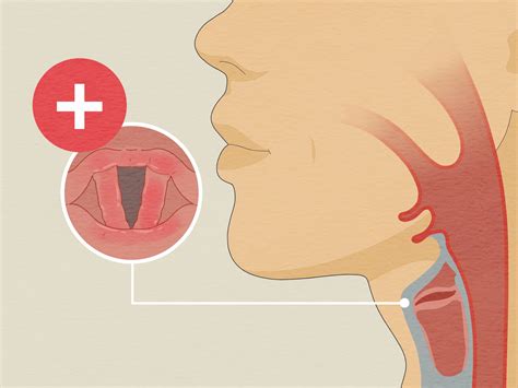 Can Dogs Strain Vocal Cords