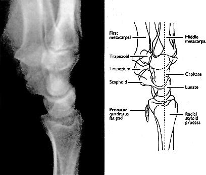 abc  emergency radiology  wrist  bmj