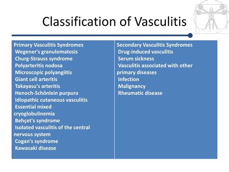 PPT - Vasculitis PowerPoint Presentation, free download - ID:4571797