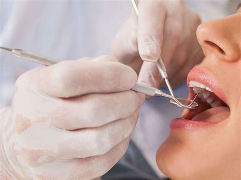 Dental Fees in Essex & Thurrock - Tooth Doctor