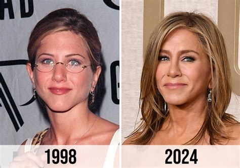 A Doctor Says Jennifer Aniston’s Face Is ‘Overfilled’ And Explains Why ... 