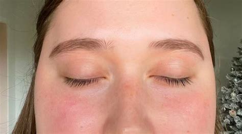 reddish face causes 4