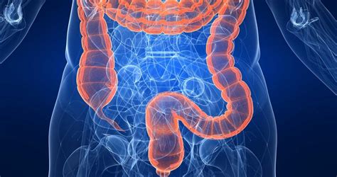 Virtual Colonscopy, CT Colonography Scan, CT Bowel Scan