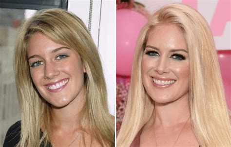 Heidi Montag Archives - Life & Style