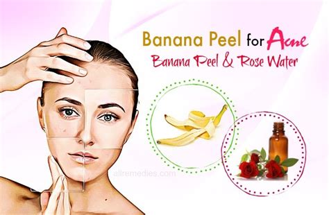 11 Ways How To Use Banana Peel For Acne & Pimples – Does It Work?