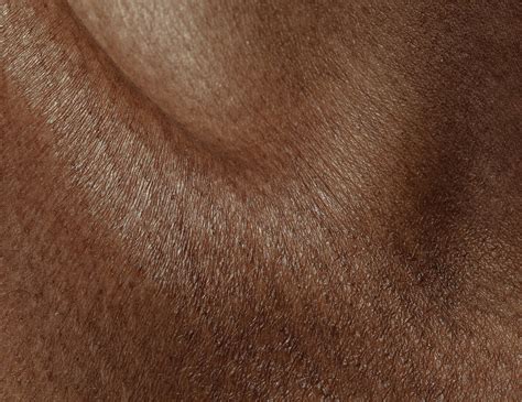 Dry Skin Type - Everything You Need To Know – Prequel