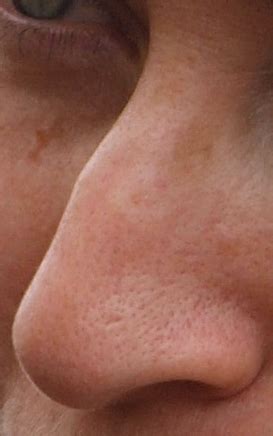 Human nose - Wikipedia 