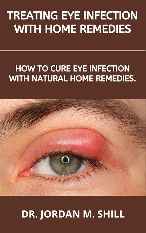 TREATING EYE INFECTION WITH HOME REMEDIES: HOW TO CURE EYE INFECTION ...