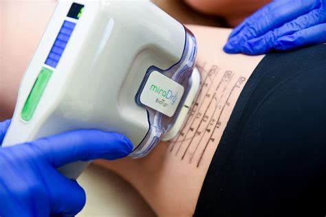 benefits  miradry treatment jaxtr