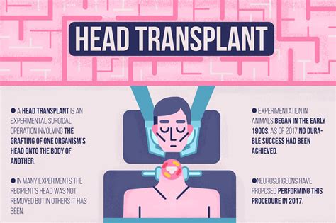 Human Head Transplant Infographics By Ollysweatshirt | TheHungryJPEG