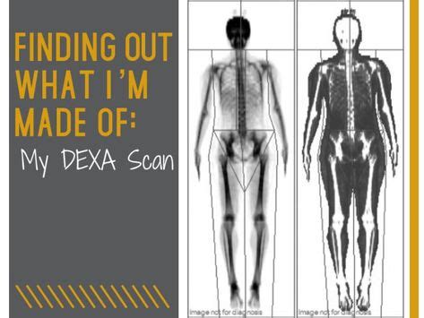 33 Best DXA Body Composition Scan images in 2020 | Body composition, Body, Scan