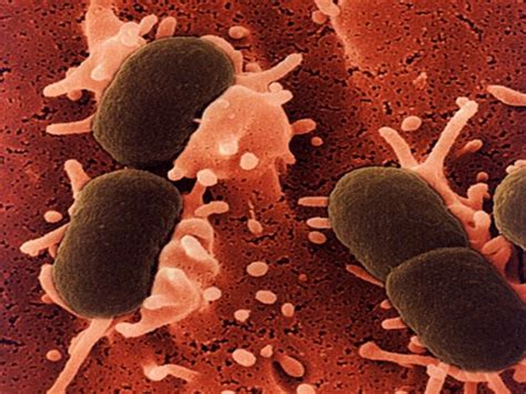 E. Coli (Escherichia Coli) Infection Causes, Symptoms, Diagnosis ...