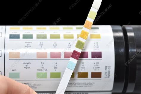 Urine test strip showing ketones - Stock Image C026/9203 - Science ...