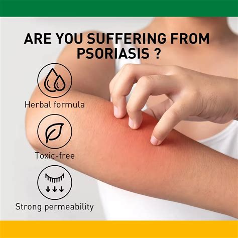 Anti-itching Cream Provides Relief From Itching and Swelling for