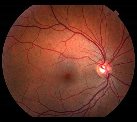 optic disc  stock  pictures royalty  images
