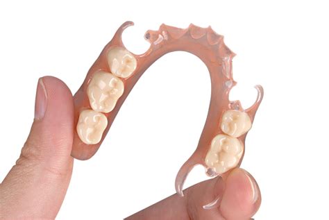 success  removable partial denture modern dental pacific