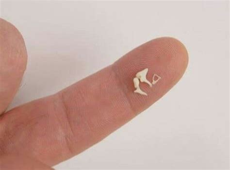 Ossicles - MEDizzy