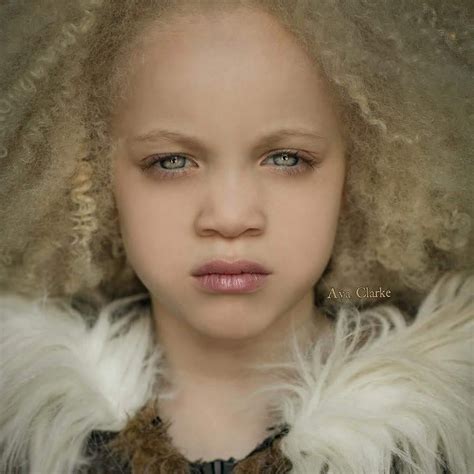 Pessoa Albina Negra - Esta niña albina de raza negra está haciendo vibrar las pasarelas. Y su ...