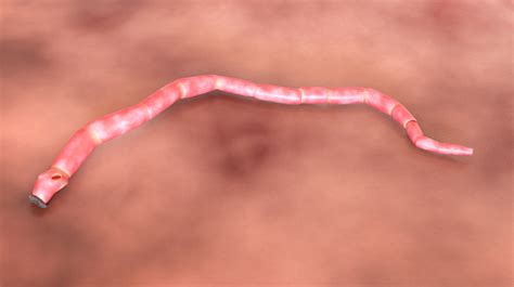 Tapeworm In Human Intestine Stock Photo - Download Image Now - iStock