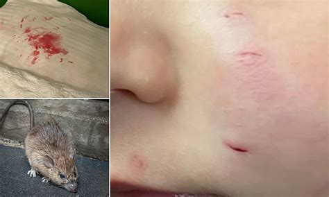 liverpool mother traumatised     rat biting  toddlers