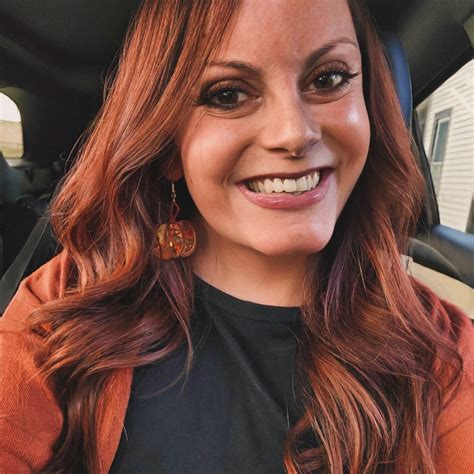 celebrities with turner syndrome 4