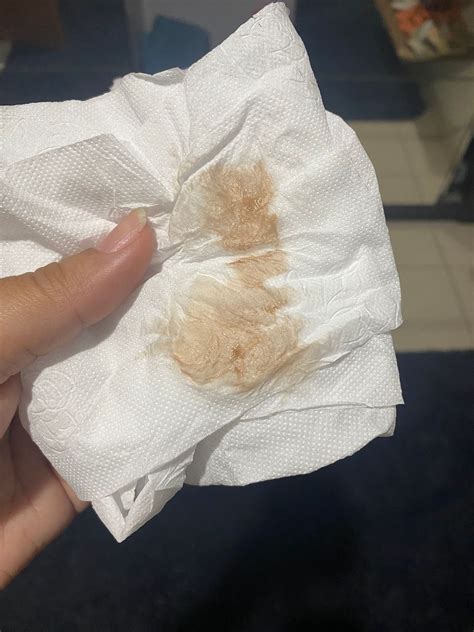 Menstruação Que Só Suja O Papel Higiênico Pode Ser Gravidez - Será que pode ser nidação meninas? | BabyCenter