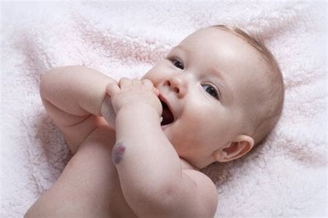 Infant Hemangiomas: Common Tumors in Infants - You are Mom