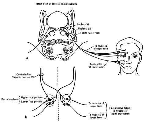 7th Cranial Nerve Palsy Facial Nerve Disorders The Aesthetic