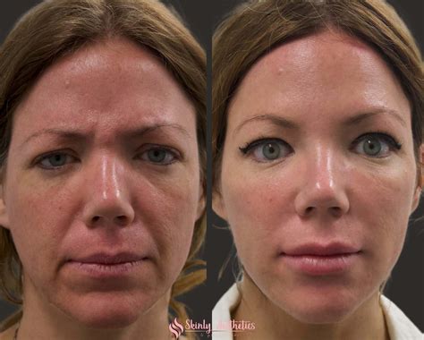 See The InfluencerGoneWild Before & After That's Going Viral! Image 15