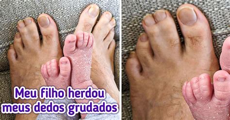 10+ Características corporais raras que tornam essas pessoas incríveis ...