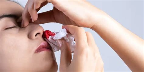 stop  nosebleed cpr  aid