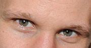 categorydoctor  eyes wikimedia commons