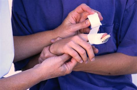 9 Common Causes of Finger Injuries