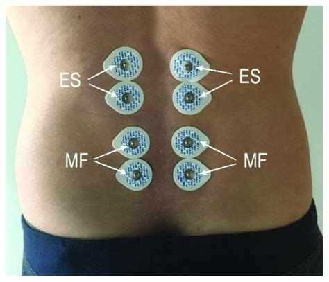 arrangement  surface electrodes  scientific diagram
