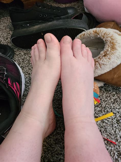 Right foot hurts in the middle and looks a bit swollen. Left foot for
