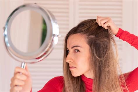 types  hair loss