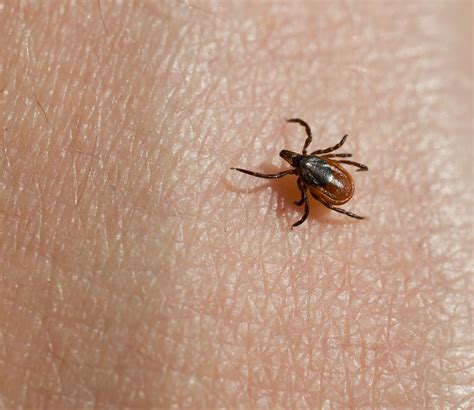 Types Of Ticks That Carry Lyme Disease