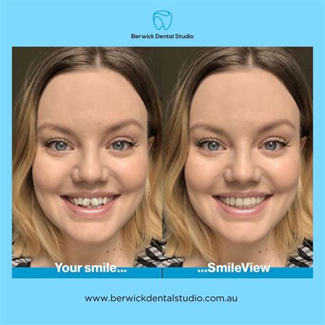 Want to see what your future smile could look like using the power of ...