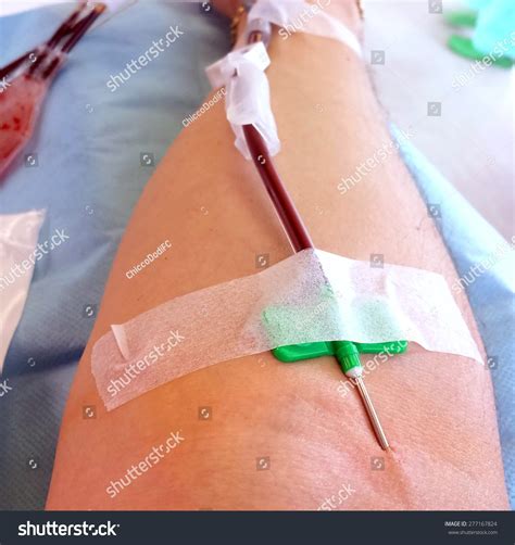 Blood Donor During Transfusion Hospital Needle Stock Photo 277167824