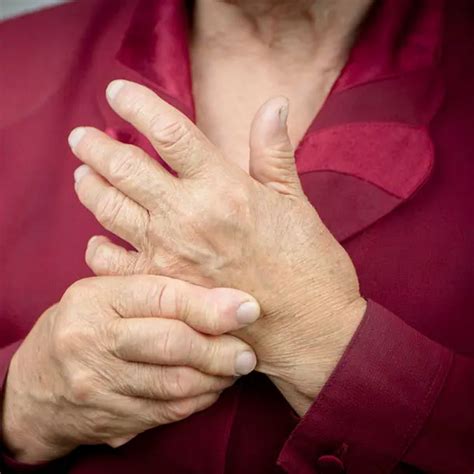 Rashes from Rheumatoid Arthritis: Symptoms, Causes, Treatment