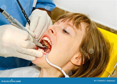 open mouth stock image image  procedure intervention