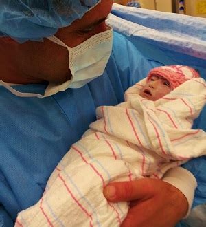 pictures of babies with anencephaly