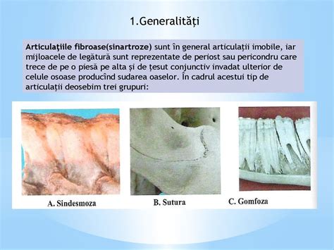 Tema 7. Morfologia articulatiilor - online presentation