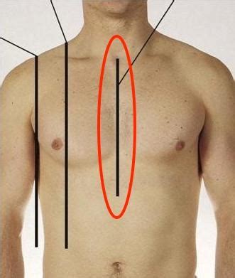 nurs landmarks quiz flashcards quizlet