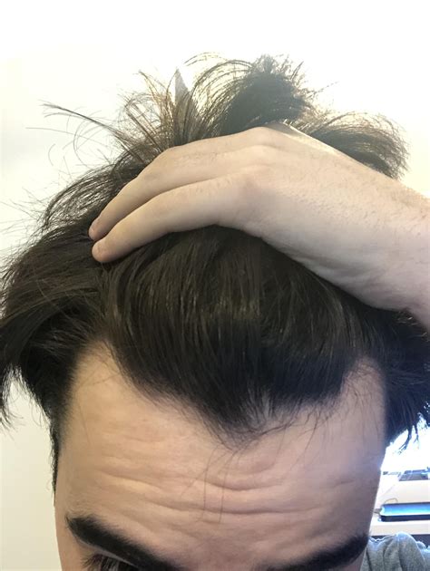 Learn how to style different guys haircuts with widows peak 13