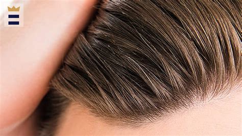 Dry Scalp Flakes