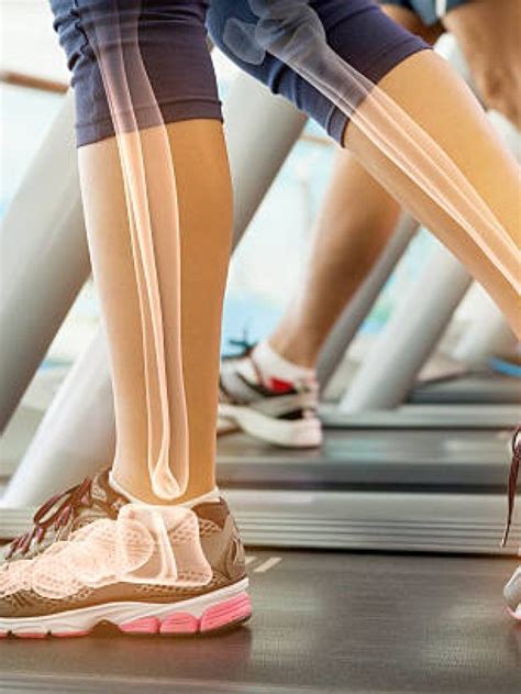 top   bone building foods