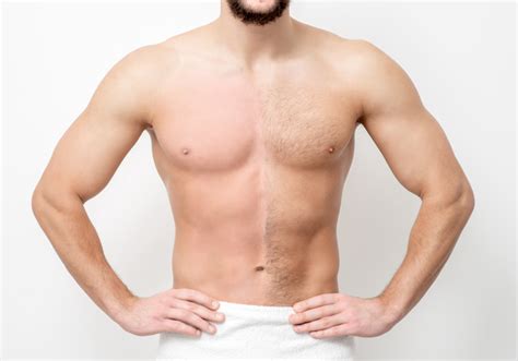 Banish Ingrown Hairs with Laser Hair Removal | Versailles Medical Spa